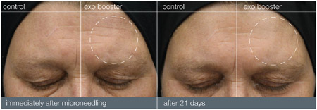 facials salisbury